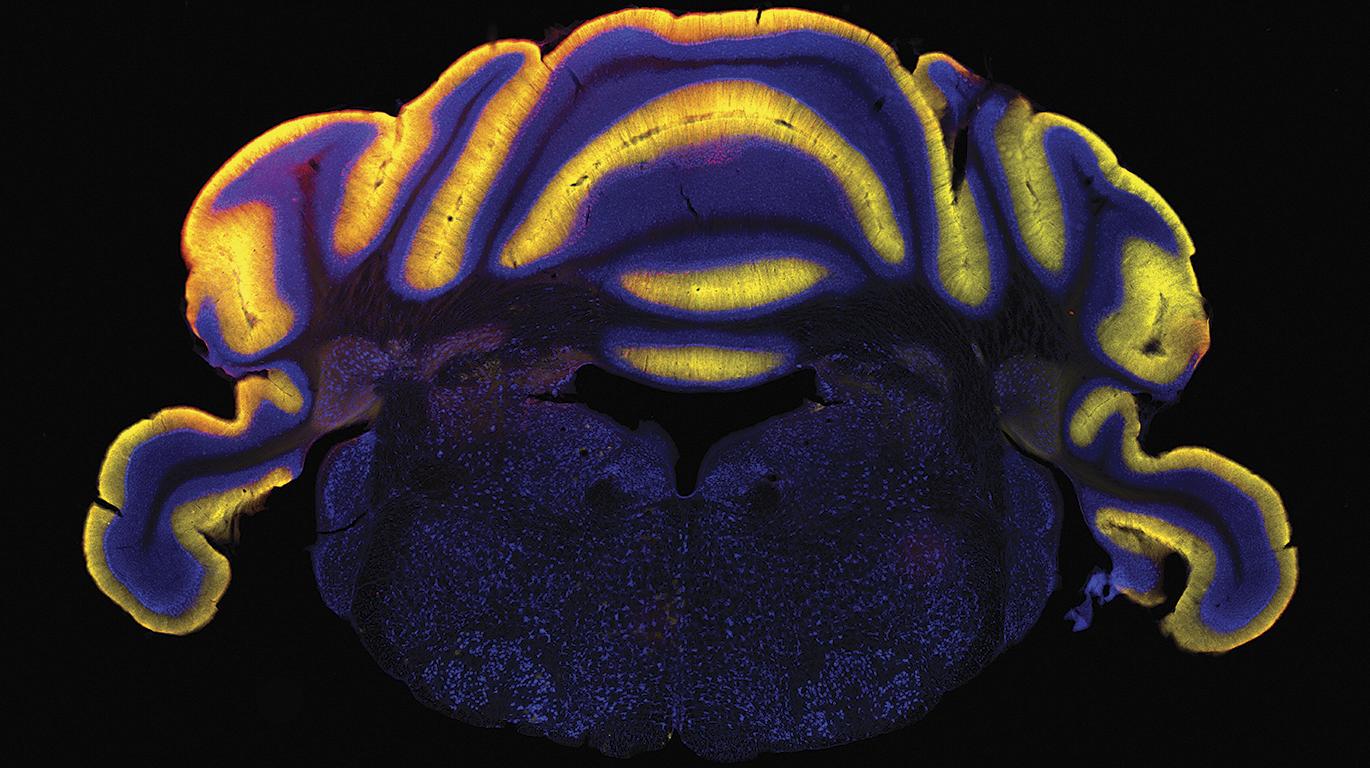 Neural Circuits and Behavior