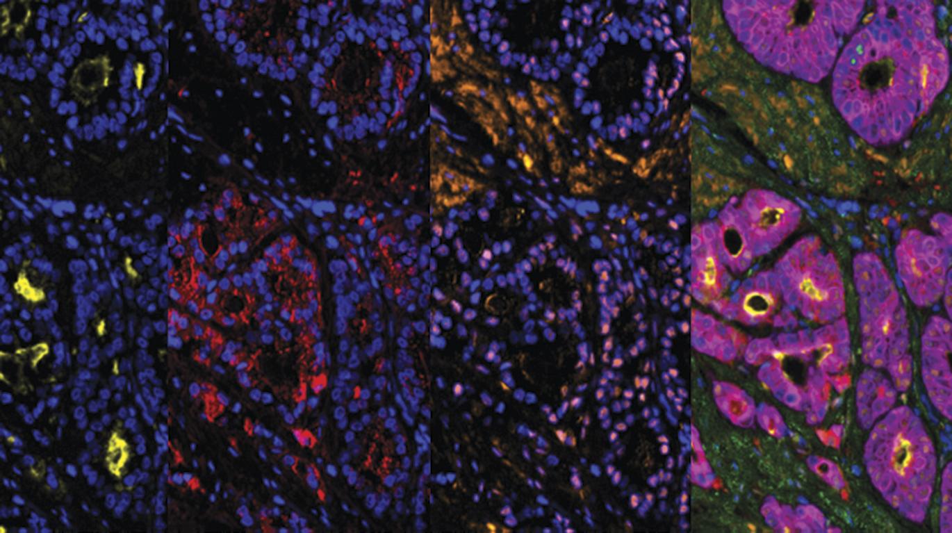 Telomeres, ageing and cancer