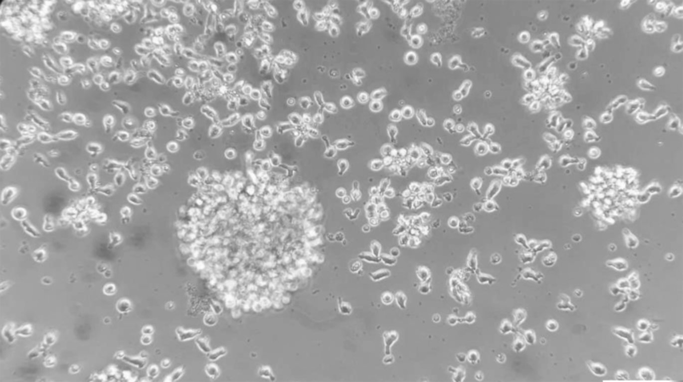 Immunotherapy / ImmunoSurgery