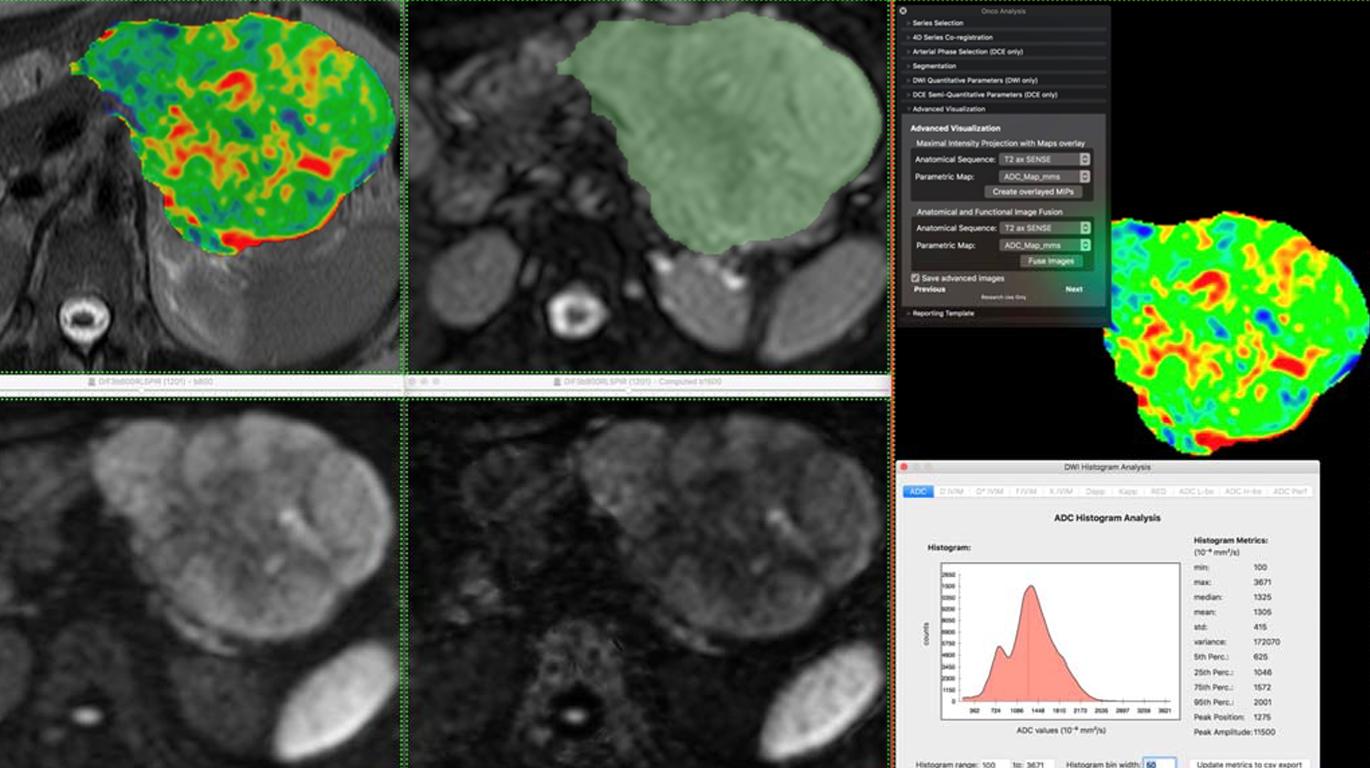 Computational Clinical Imaging Group