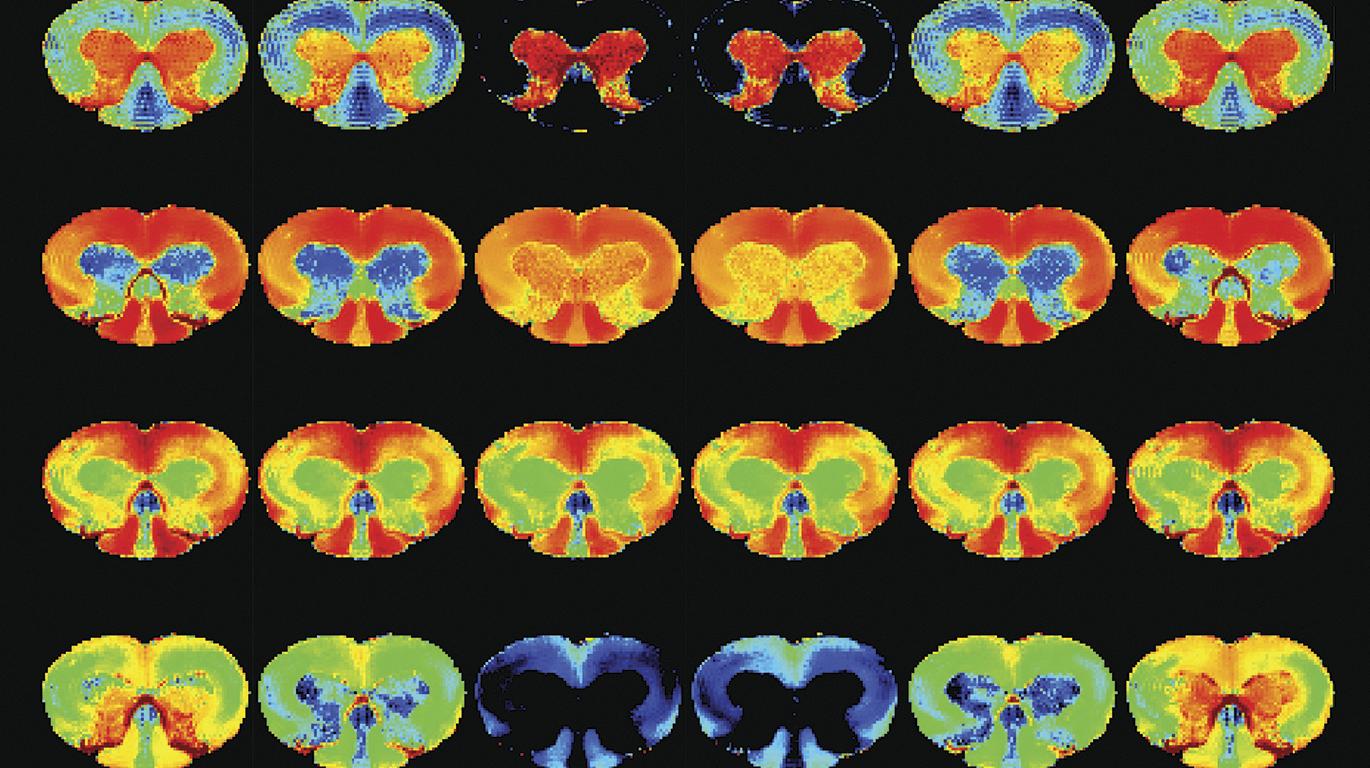 Neuroplasticity and Neural Activity
