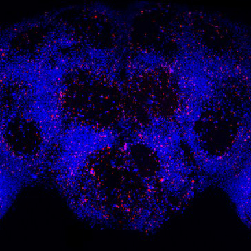 Perder neurónios pode não ser assim tão mau