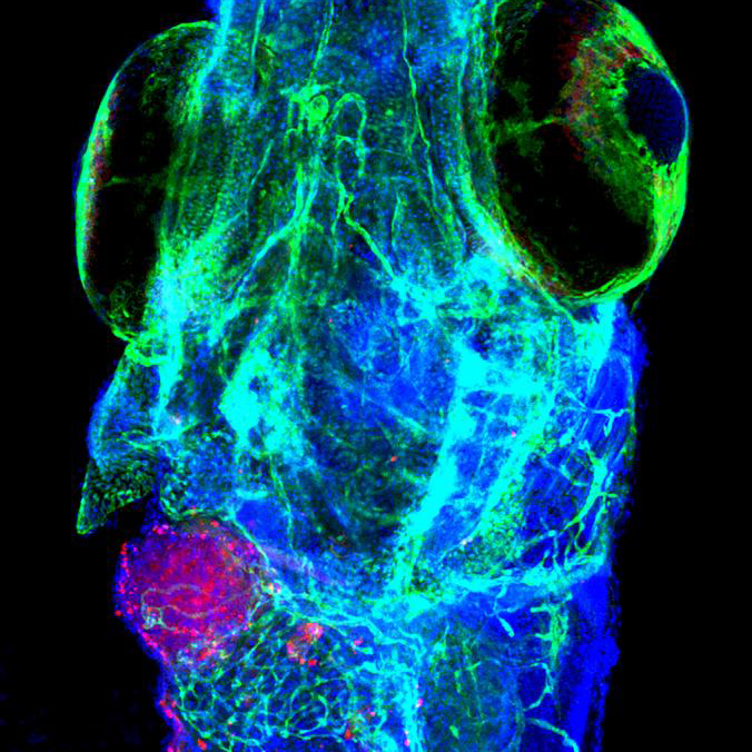 A personalização da medicina: National Geographic