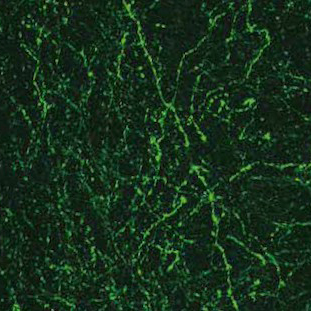 Dizer ao cérebro para onde não olhar.